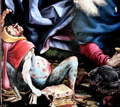 Image result for Ergotism