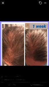 Hair washing, like bathing, was not an important part of americans' hygiene practices before the turn of the century. Pin On True Science Hair Care System