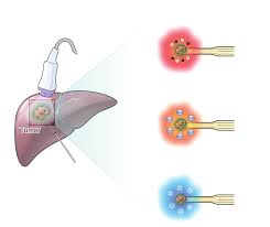 2023 Korean Multidisciplinary Guidelines for Colon Cancer Management:  Summary of Radiological Points