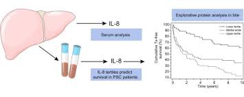 Maybe you would like to learn more about one of these? Novel Serum And Bile Protein Markers Predict Primary Sclerosing Cholangitis Disease Severity And Prognosis Sciencedirect