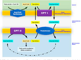 Figure 1 From Acute Respiratory Infection Unveiling Cpt Ii Deficiency Semantic Scholar