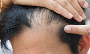 Maybe you would like to learn more about one of these? I Have An Itchy Scalp Do I Have Scalp Psoriasis Orlando Fl Dr Jeannette Hudgens
