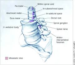 Manifestations of metastatic and advanced prostate cancer may include the following: Neurologic Complications Of Prostate Cancer American Family Physician