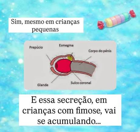 Ainda sobre o tema: “bolinhas”… Não é incomum surgirem bolinhas brancas ao redor da glande ou prepúcio dos meninos pequenos. Muitas pais se assustam e pensam que é pus ou alguma infecção.