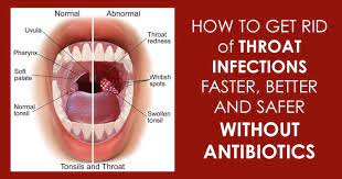 Home Remedies Are Always Effective And They Don T Have Any Side Effects Like Medicines Antibiotics Throat Infection Strep Throat Strep Throat Remedies