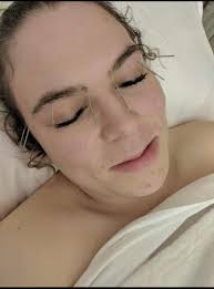 Emily Robichaud RMT, R.Ac