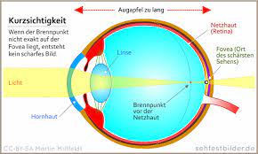 Ab sofort können diese … Sehtest Zum Ausdrucken Sehtestbilder