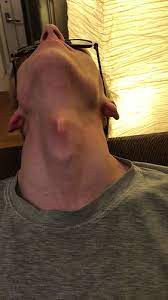 Flickr adams apple (page 1). Untitled A A Flickr