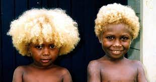 White baby born to black parents. Black People With Natural Blonde Hair Melanesian Population Afroculture Net
