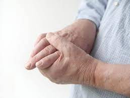 Penyakit ini umumnya disebabkan oleh gerakan tangan yang berulang, fraktur (patah) pada apa tandanya ketika kesemutan perlu diwaspadai? Penyebab Tangan Kesemutan Tidak Sesepele Kelihatannya Alodokter