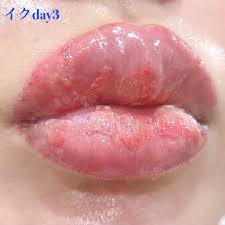 ヘルペス 化粧 し て も 大丈夫