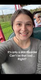 chronically.c.a.m (@chronically.c.a.m)