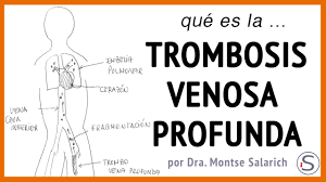 La vena mesentérica superior está más frecuentemente involucrada. Trombosis Venosa Profunda Youtube