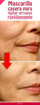 Mascarilla Casera Para Quitar Arrugas Rapidamente Rejuveneciiento Facial Piel Rostro Cara Spots On Face Skin Treatments Beauty Secrets