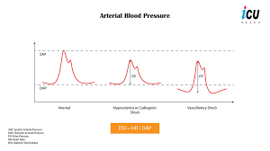 Image result for Shock Index