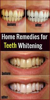 Pin On Whitening