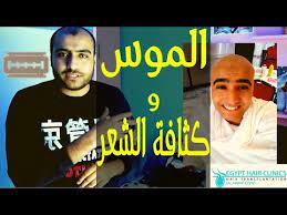 هل الحلاقة بالموس بتتقل الشعر الخفيف hair transplat youtube