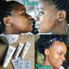 Revitalize & rejuvenate your skin while helping to reduce the visible signs of aging. Coach Mbali Ø¹Ù„Ù‰ ØªÙˆÙŠØªØ± Get Yourself Started On Herbalife Available For Skin Weight Management Hair Ramaphosa Uyajola99sunday Entaglement Familyfeudsa Cyrilramaphosa Https T Co 7jq1loatxb