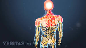 Cervical Facet Osteoarthritis Video