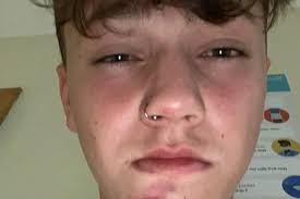 Teen face stamped in brutal gang mugging left needing brain scan