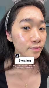 Slugging Vaseline Healing