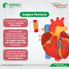 Image result for Angina Pectoris
