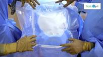 "Step-by-Step: How to Apply a Surgical Disposable Craniotomy Drape"  #craniotomy #safeops #neurology
