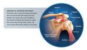 Myofascial trigger point reference including referred pain and muscle diagrams as well as symptoms caused by triggerpoints. St Clair Shoulder Injuries And You Understanding Shoulder Care St Clair Health
