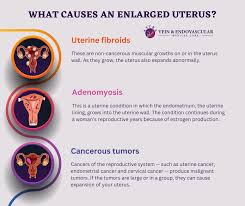 Image result for uterus