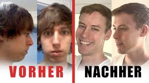 Von der Schlafapnoe geheilter Patient berichtet über seinen Weg