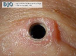 Djo Digital Journal Of Ophthalmology
