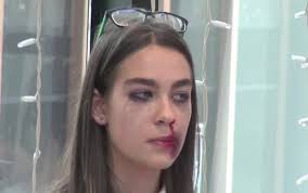 Unde, voi barbatilor, nu ati putea sa vedeti o femeie? Imagini TulburÄtoare Cu Femei BÄtute S A Enervat CÄ Nu Era Gata Mancarea Stirileprotv Ro