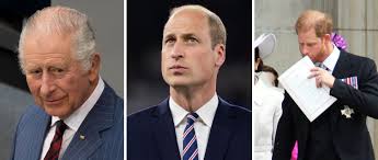 Prince Harry's Hair Transplant – Did It ...