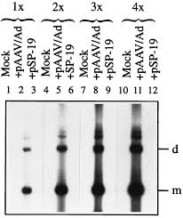 Image result for Black 1998 AAV