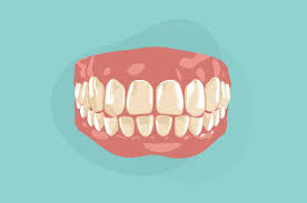 Protesa gigi/gigi palsu diberikan kepada peserta bpjs kesehatan yang kehilangan gigi sesuai dengan indikasi medis dan atas rekomendasi dari 3. Klinik Respirasi Klinik Dokter Tht Di Malang Klinik Dokter Paru Di Malang Klinik Jantung Di Malang Klinik Dokter Paru Di Surabaya Klinik Dokter Penyakit Dalam Di Malang Klinik Dokter Gigi Di Malang