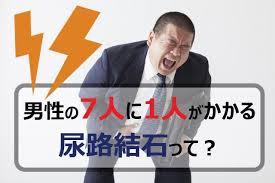 専門医解説 尿路結石の基礎知識 症状や結石の種類 治療法 再発率 まとめ カラダネ 尿路結石 症状 治療