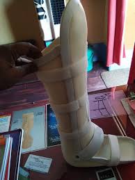 The extended anterior shell covers the patella (sarmiento ptb design) and provides additional medial/lateral support. Tfo Ptb Astha Ortho Care Rehabilitation Aids Facebook