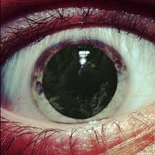 Browse the user profile and get inspired. Gif Ojo Melok Melok Ocular Migraines Shouldn T Exist But They Do So Here S What To Know Self Olya Sahhq