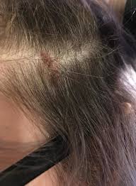In this post we share super easy and cute hairstyles for curly hair, as well as tips on how to style and care for curly hair. Monat Is Suing A Woman Who Said Their Products Are A Nightmare