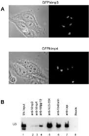 Palco mp3 baixar musicas brasileiras. Mimp3 Partially Complements The Growth Defect Of A Yeast Imp3 Null Download Scientific Diagram