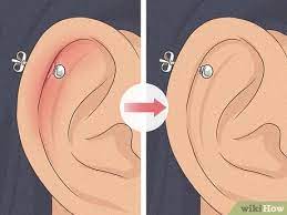 5 Ways To Heal Cartilage Piercing Bumps Wikihow