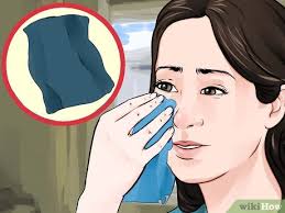 In females, the most common area is the armpit, near the genitals and legs. 4 Ways To Remove Ingrown Hair On Your Face Wikihow