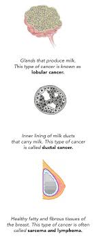 These sores are often painless, so do not wait until you feel pain before you seek help. 7 Warning Signs Of Breast Cancer In Indian Women 2021 Updated