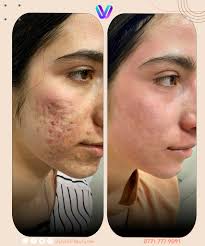 فيولا للتجميل الطبي