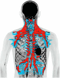Maybe you would like to learn more about one of these? Mapping Of Human Brown Adipose Tissue In Lean And Obese Young Men Pnas