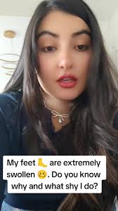 Francesca Swollen Feet