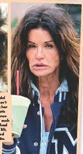 One common issue for 75% of americans over the age of 60 is. Plastic Surgery Gone Wrong Pressreader