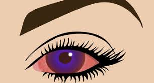How can i change my eye color permanently? 4 Ways To Change Your Eye Color Wikihow