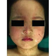 Letter to the Editor