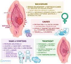 Bartholin Cyst: What Is It, Causes, And More | Osmosis